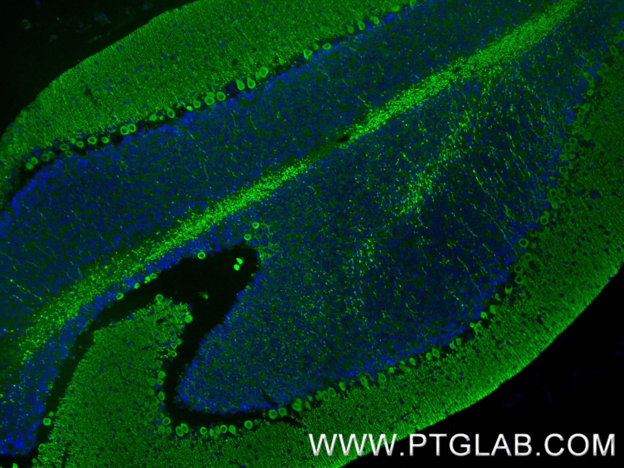 Immunofluorescence (IF) / fluorescent staining of mouse cerebellum tissue using CA8 Recombinant monoclonal antibody (86004-1-RR)