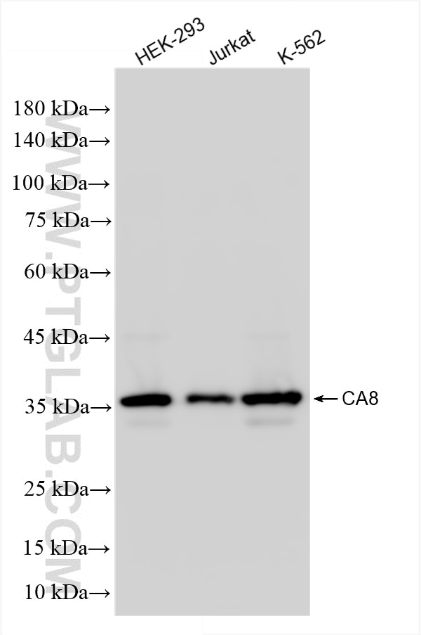 Western Blot (WB) analysis of various lysates using CA8 Recombinant antibody (86004-2-RR)