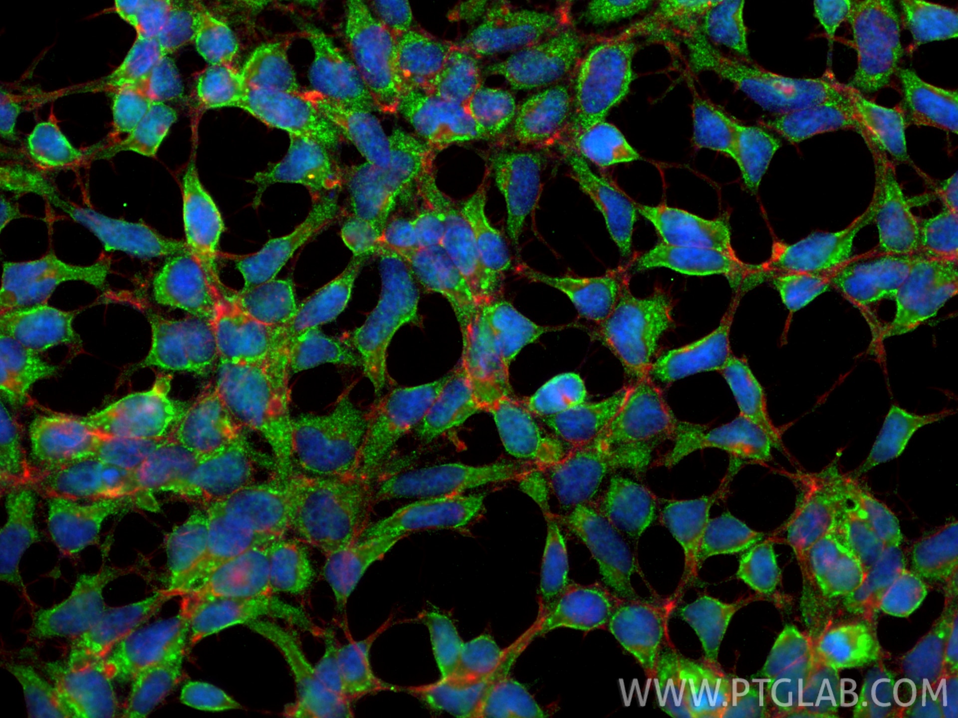 Immunofluorescence (IF) / fluorescent staining of HEK-293 cells using Carbonic Anhydrase IX/CA9 Polyclonal antibody (11071-1-AP)