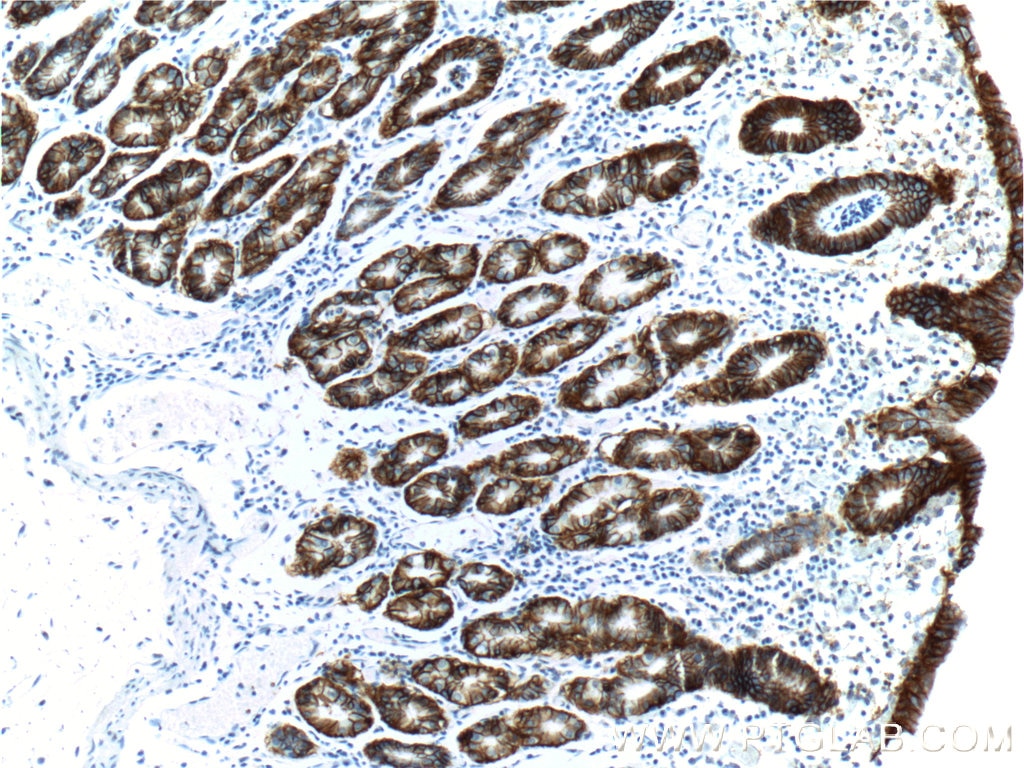 Immunohistochemistry (IHC) staining of human stomach tissue using CA9 Polyclonal antibody (11071-1-AP)