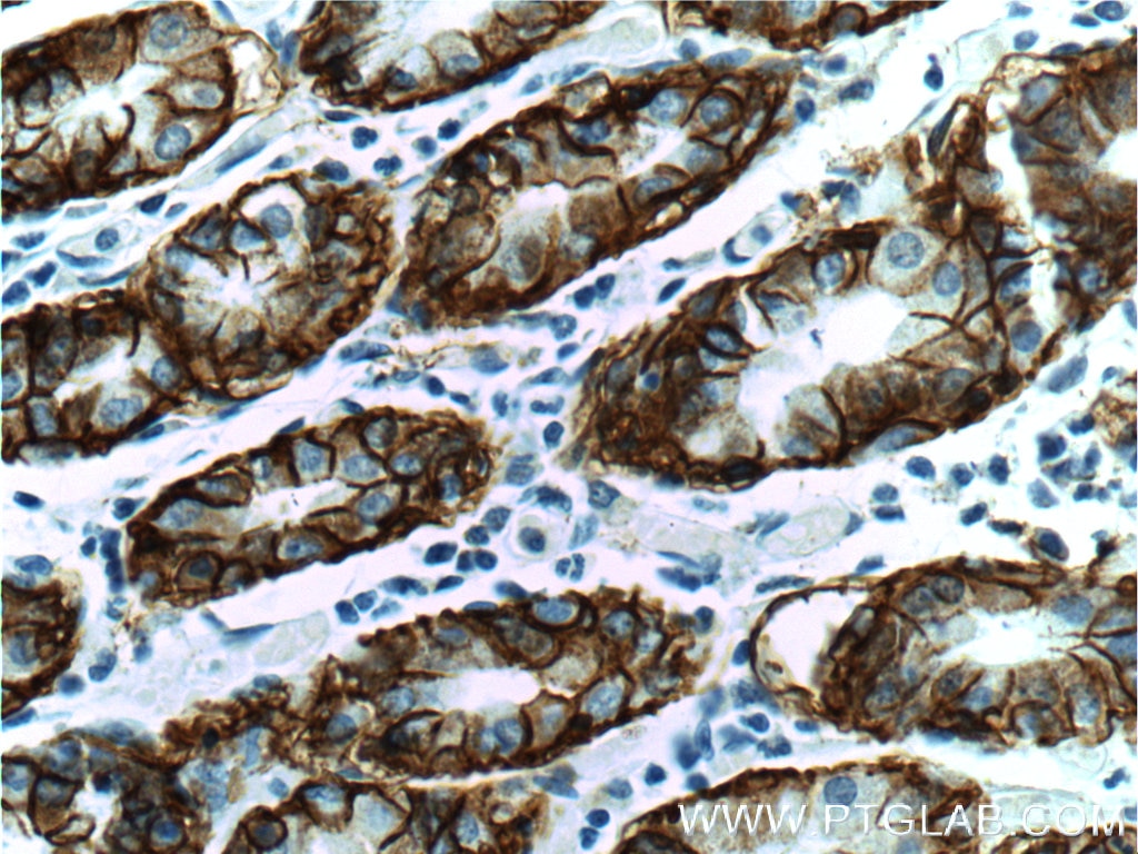 Immunohistochemistry (IHC) staining of human stomach tissue using CA9 Polyclonal antibody (11071-1-AP)