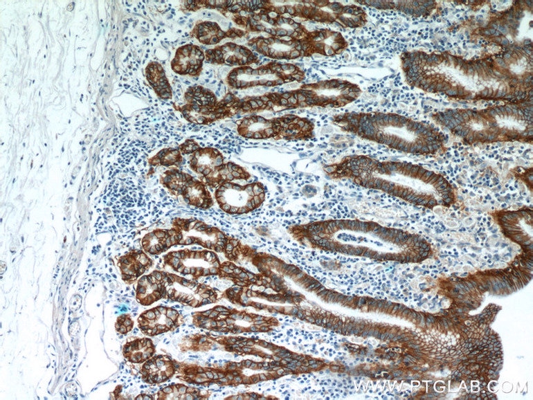 Immunohistochemistry (IHC) staining of human stomach tissue using CA9 Polyclonal antibody (11071-1-AP)