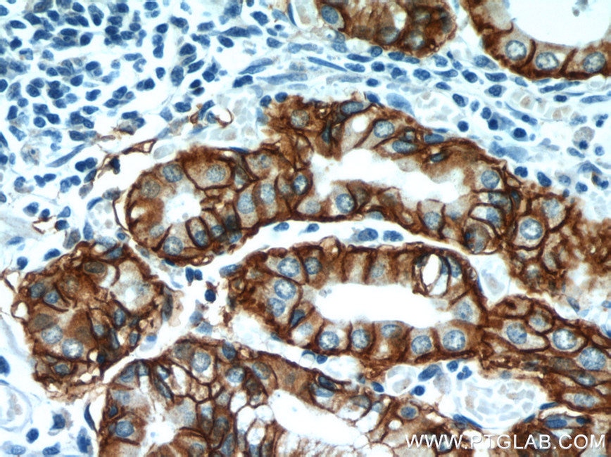 Immunohistochemistry (IHC) staining of human stomach tissue using CA9 Polyclonal antibody (11071-1-AP)