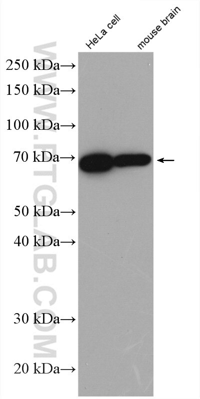 Western Blot (WB) analysis of HeLa cells using CA9 Polyclonal antibody (11071-1-AP)