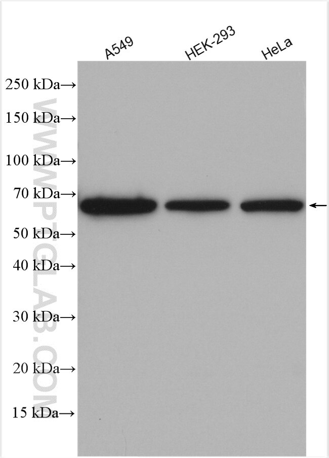 Western Blot (WB) analysis of various lysates using CA9 Polyclonal antibody (11071-1-AP)