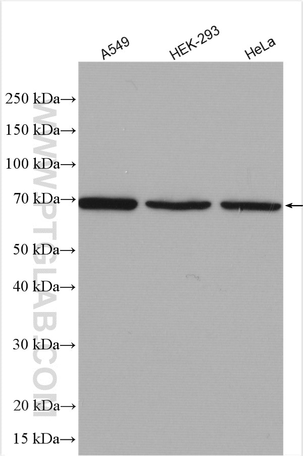 Western Blot (WB) analysis of various lysates using CA9 Polyclonal antibody (11071-1-AP)