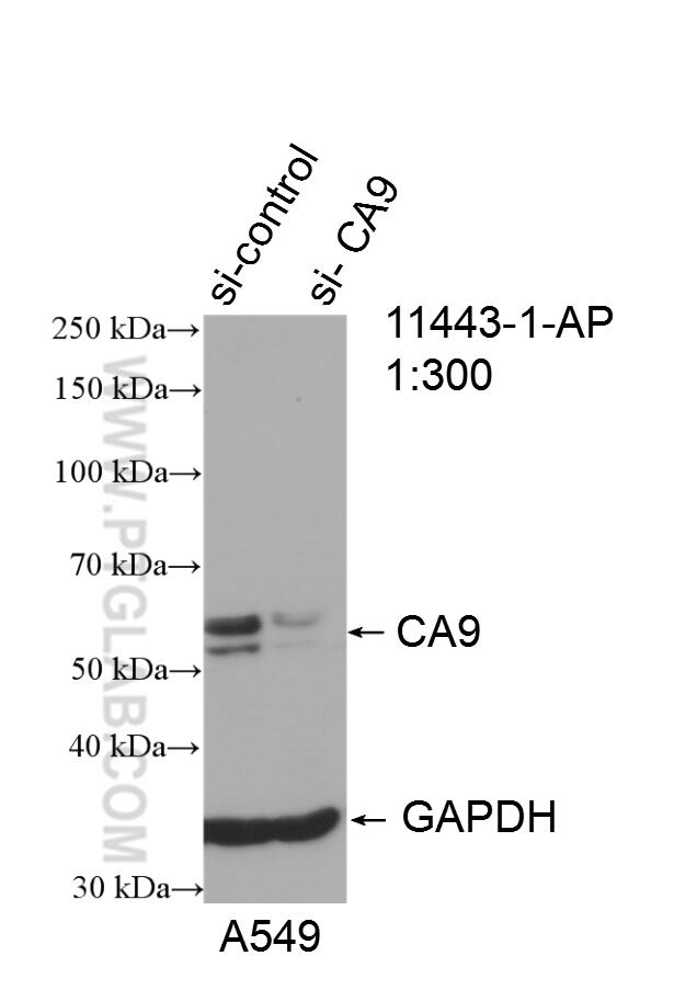 Western Blot (WB) analysis of A549 cells using CA9 Polyclonal antibody (11443-1-AP)