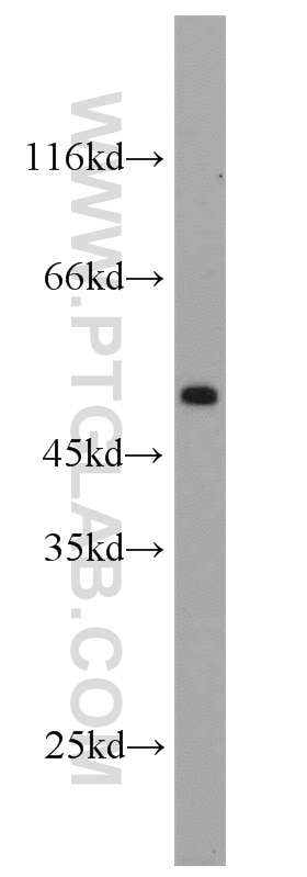 Western Blot (WB) analysis of mouse brain tissue using CA9 Polyclonal antibody (11443-1-AP)