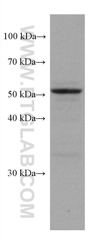 Western Blot (WB) analysis of U-87 MG cells using CA9 Monoclonal antibody (66243-1-Ig)