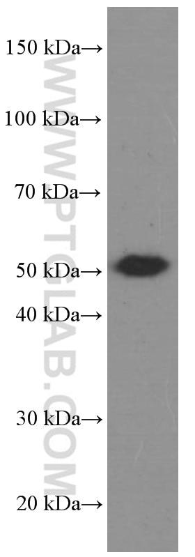 Western Blot (WB) analysis of pig stomach tissue using CA9 Monoclonal antibody (66243-1-Ig)