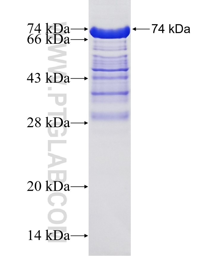 CA9 fusion protein Ag1256 SDS-PAGE