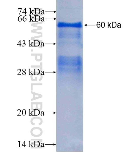 CA9 fusion protein Ag1963 SDS-PAGE