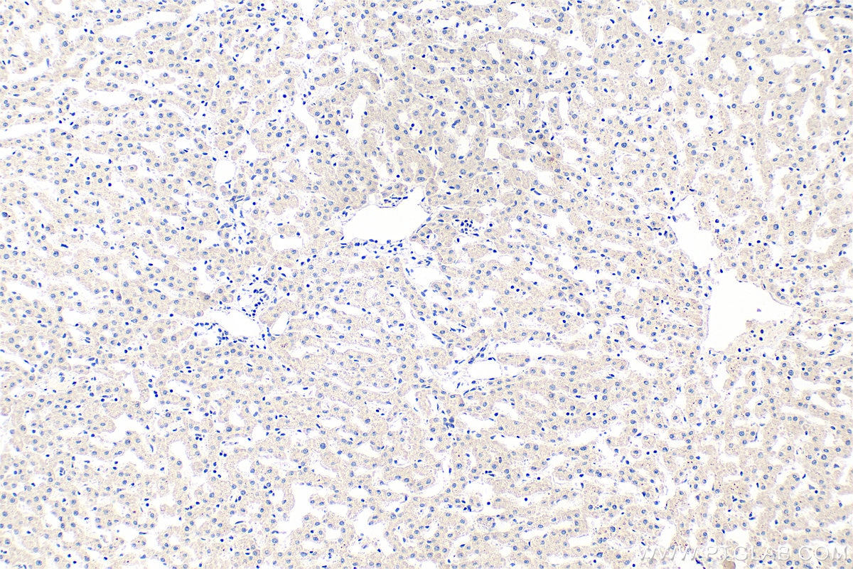 Immunohistochemistry (IHC) staining of human liver tissue using CAAP1 Polyclonal antibody (26213-1-AP)