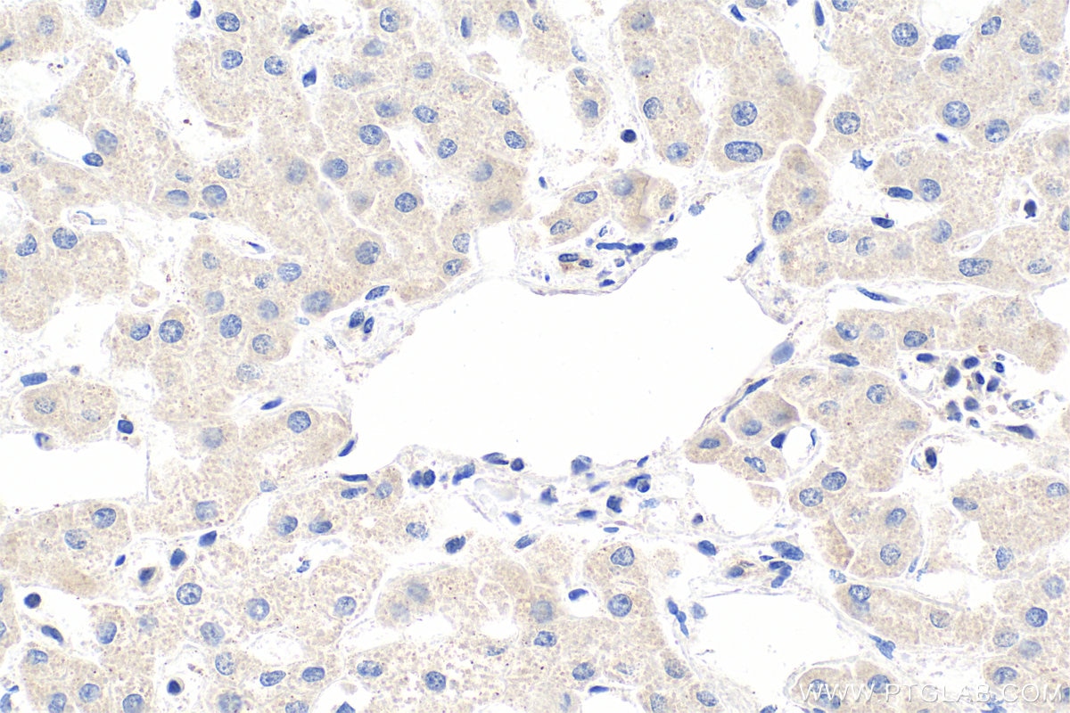 Immunohistochemistry (IHC) staining of human liver tissue using CAAP1 Polyclonal antibody (26213-1-AP)