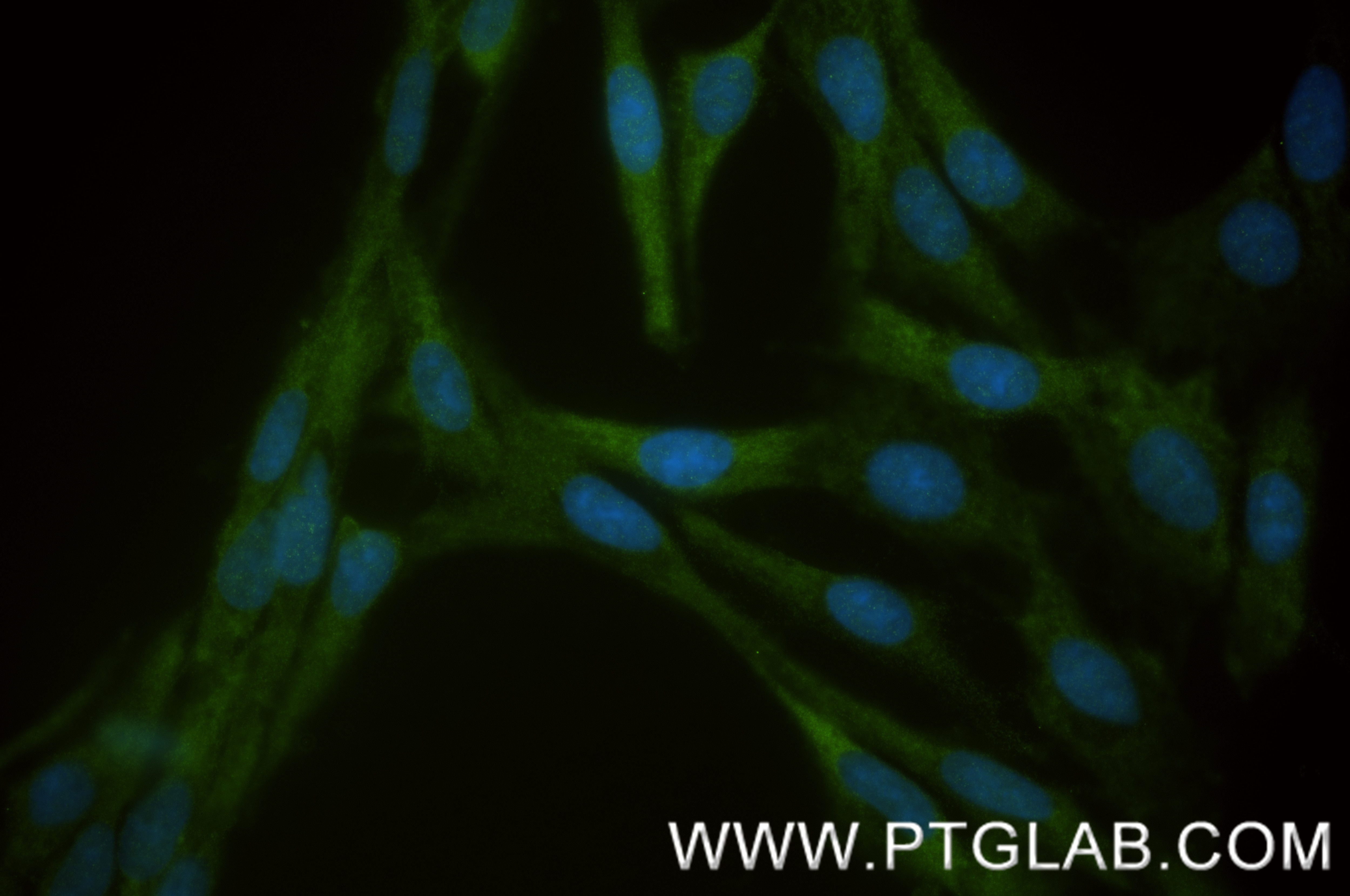 Immunofluorescence (IF) / fluorescent staining of C6 cells using CAB39 Recombinant antibody (84760-4-RR)