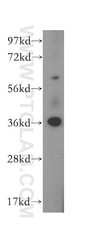 Western Blot (WB) analysis of HEK-293 cells using CAB39L Polyclonal antibody (16137-1-AP)