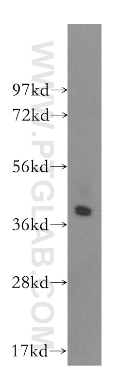 Western Blot (WB) analysis of human spleen tissue using CAB39L Polyclonal antibody (16137-1-AP)