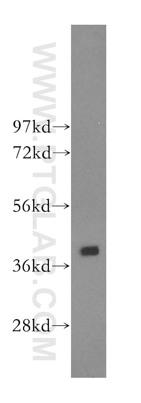 Western Blot (WB) analysis of K-562 cells using CAB39L Polyclonal antibody (16137-1-AP)