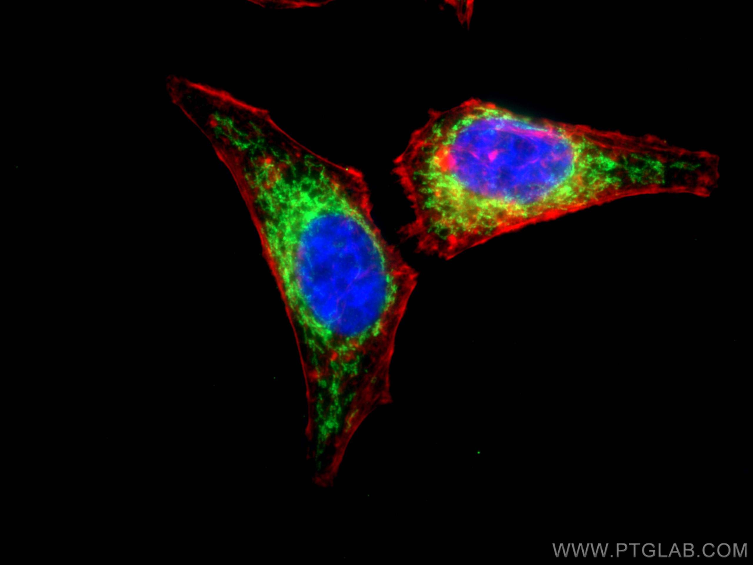 Immunofluorescence (IF) / fluorescent staining of HepG2 cells using CABC1 Polyclonal antibody (15528-1-AP)