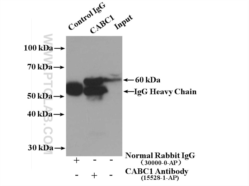 Immunoprecipitation (IP) experiment of mouse heart tissue using CABC1 Polyclonal antibody (15528-1-AP)