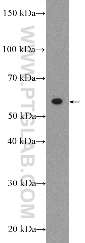 WB analysis of mouse heart using 15528-1-AP