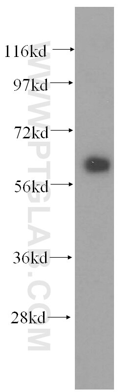 Western Blot (WB) analysis of human skeletal muscle tissue using CABC1 Polyclonal antibody (15528-1-AP)
