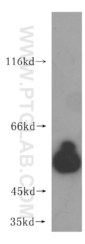 Western Blot (WB) analysis of human heart tissue using CABC1 Polyclonal antibody (15528-1-AP)