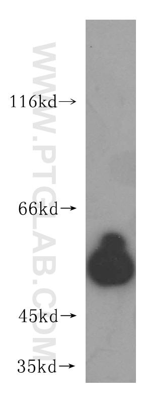WB analysis of human heart using 15528-1-AP