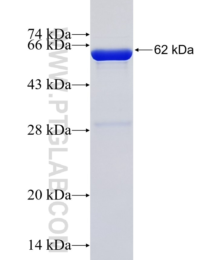CABIN1 fusion protein Ag35666 SDS-PAGE