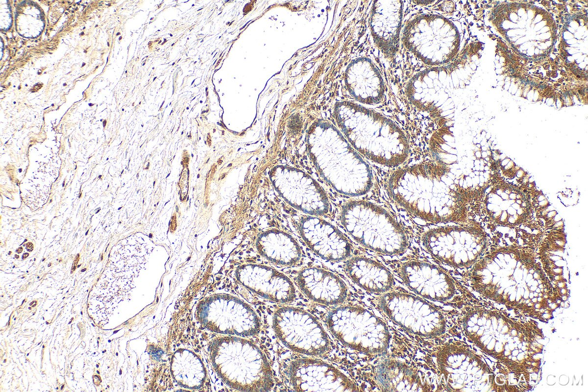 Immunohistochemistry (IHC) staining of human colon tissue using CABLES1 Polyclonal antibody (13464-1-AP)