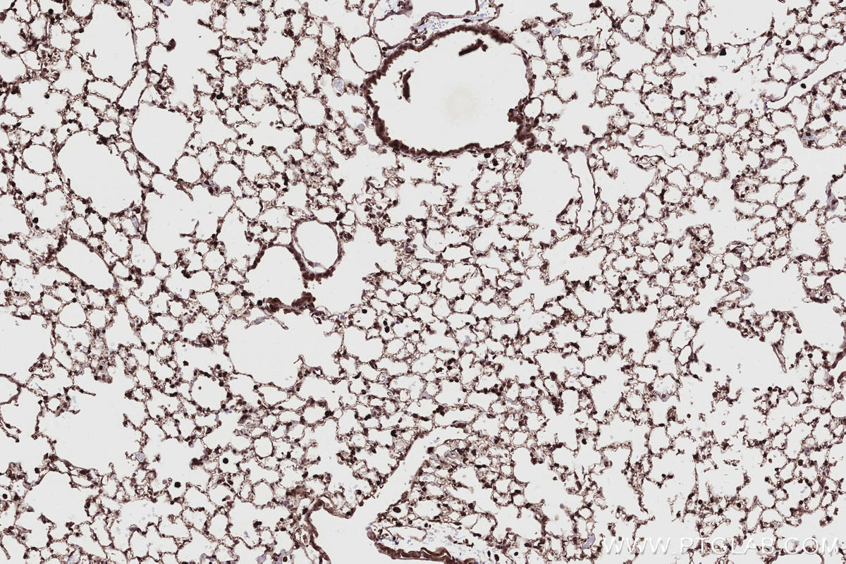 IHC staining of mouse lung using 13464-1-AP Immunohistochemistry (IHC) staining of mouse lung tissue using CABLES1 Polyclonal antibody (13464-1-AP)
