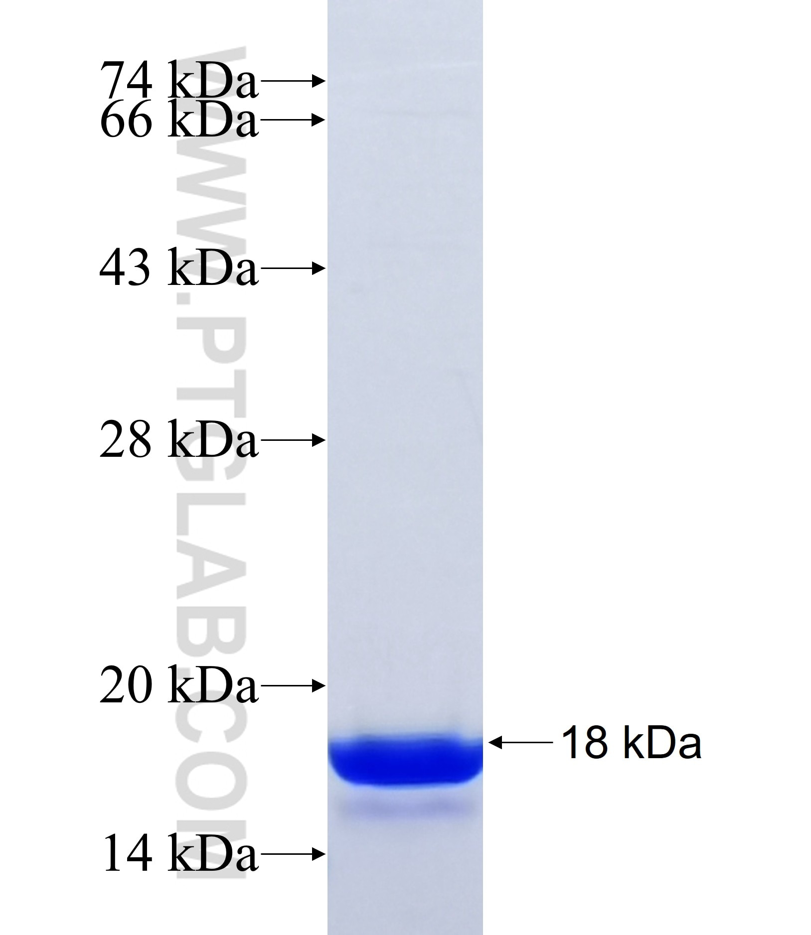 CABLES1 fusion protein Ag34794 SDS-PAGE CABLES1 fusion protein Ag34794 SDS-PAGE