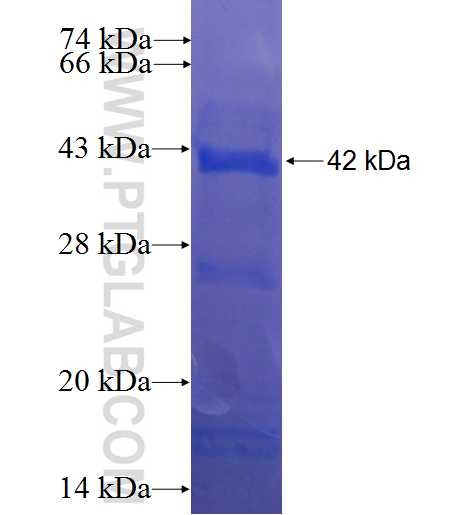 CABLES1 fusion protein Ag6848 SDS-PAGE