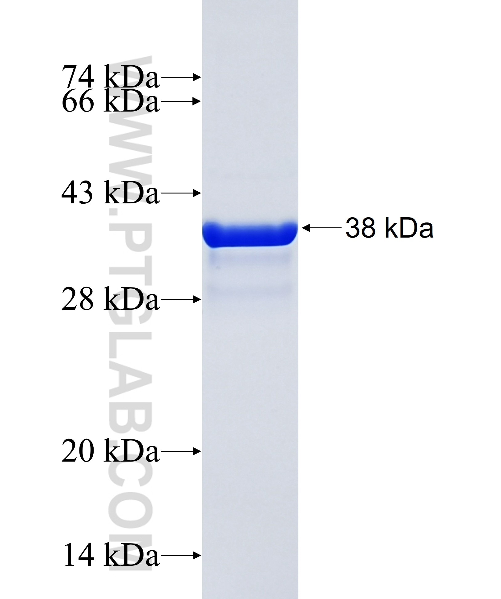 CABP2 fusion protein Ag35197 SDS-PAGE CABP2 fusion protein Ag35197 SDS-PAGE