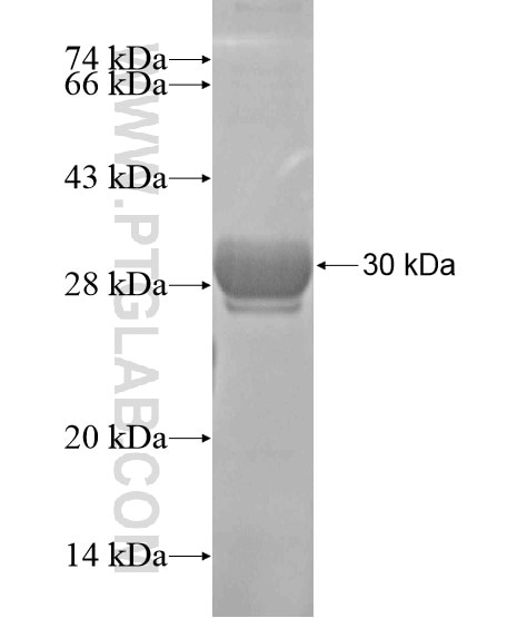 CABP5 fusion protein Ag19221 SDS-PAGE