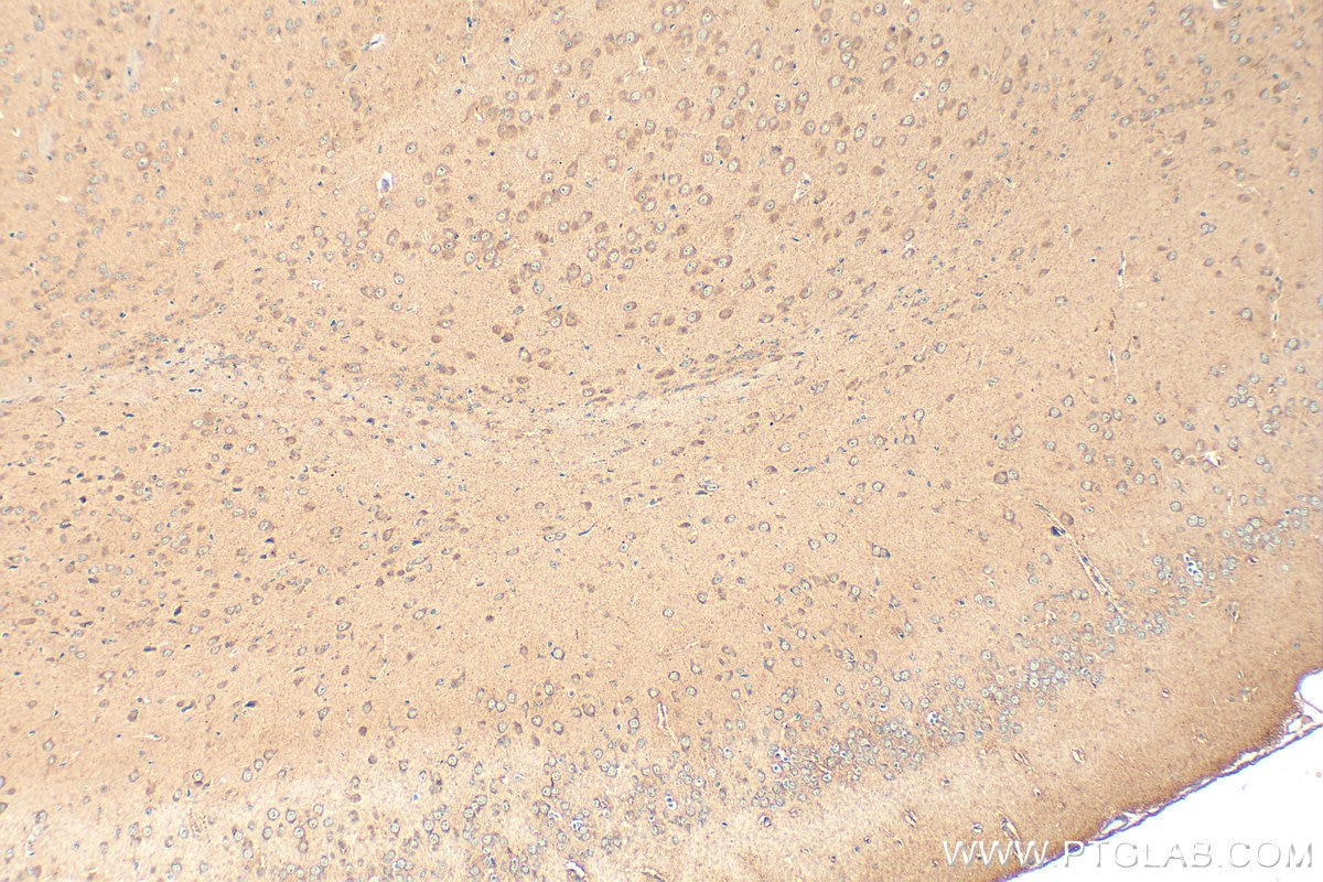 Immunohistochemistry (IHC) staining of mouse brain tissue using CABP7 Polyclonal antibody (17675-1-AP)