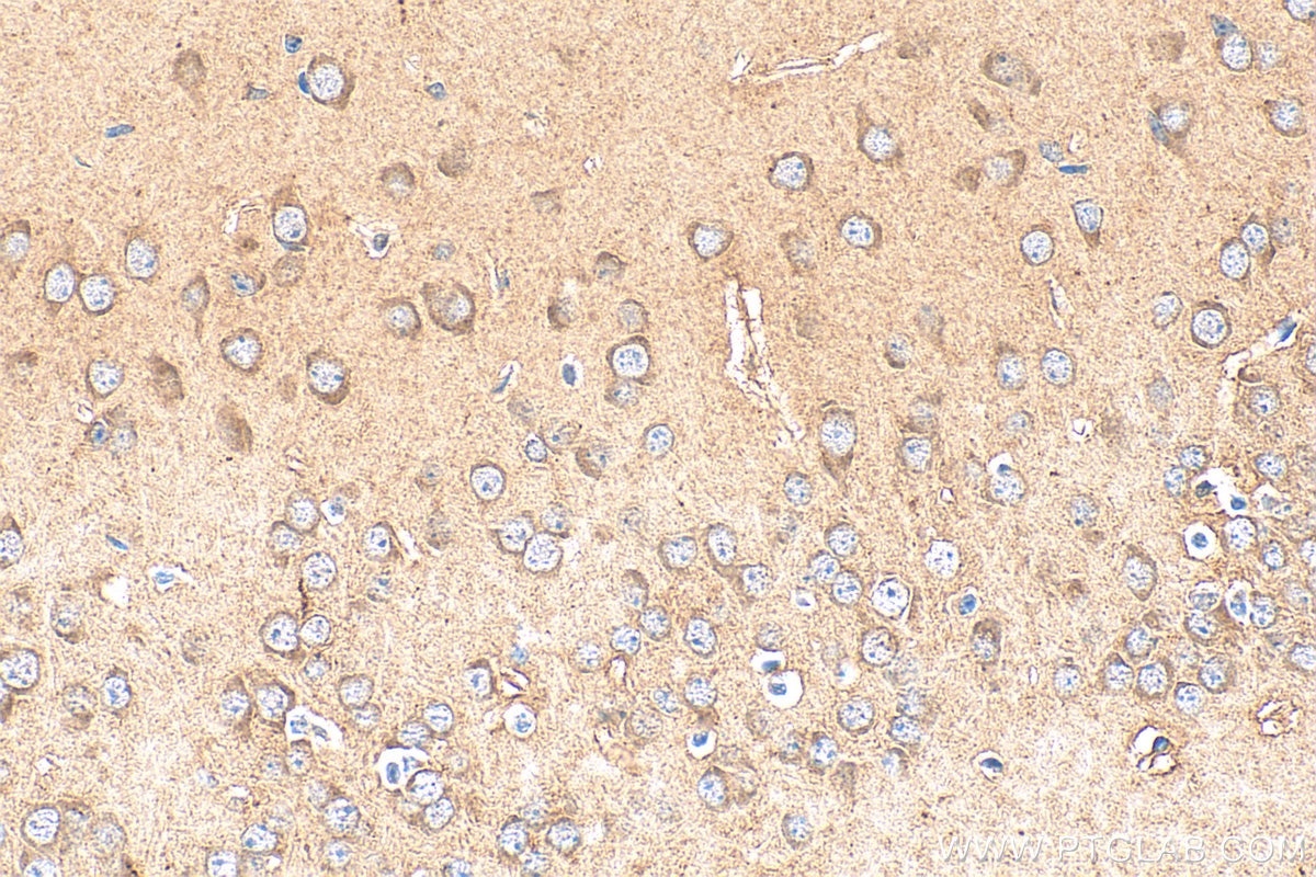Immunohistochemistry (IHC) staining of mouse brain tissue using CABP7 Polyclonal antibody (17675-1-AP)