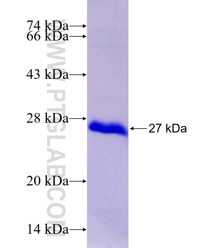 CABP7 fusion protein Ag29811 SDS-PAGE