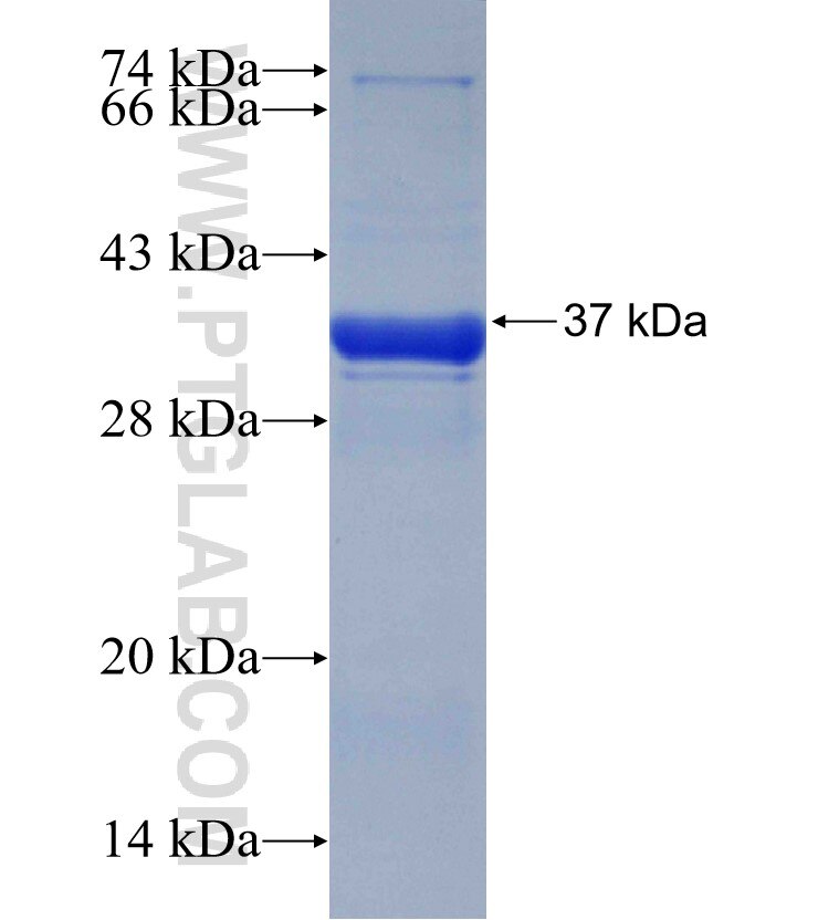 CABP7 fusion protein Ag30372 SDS-PAGE