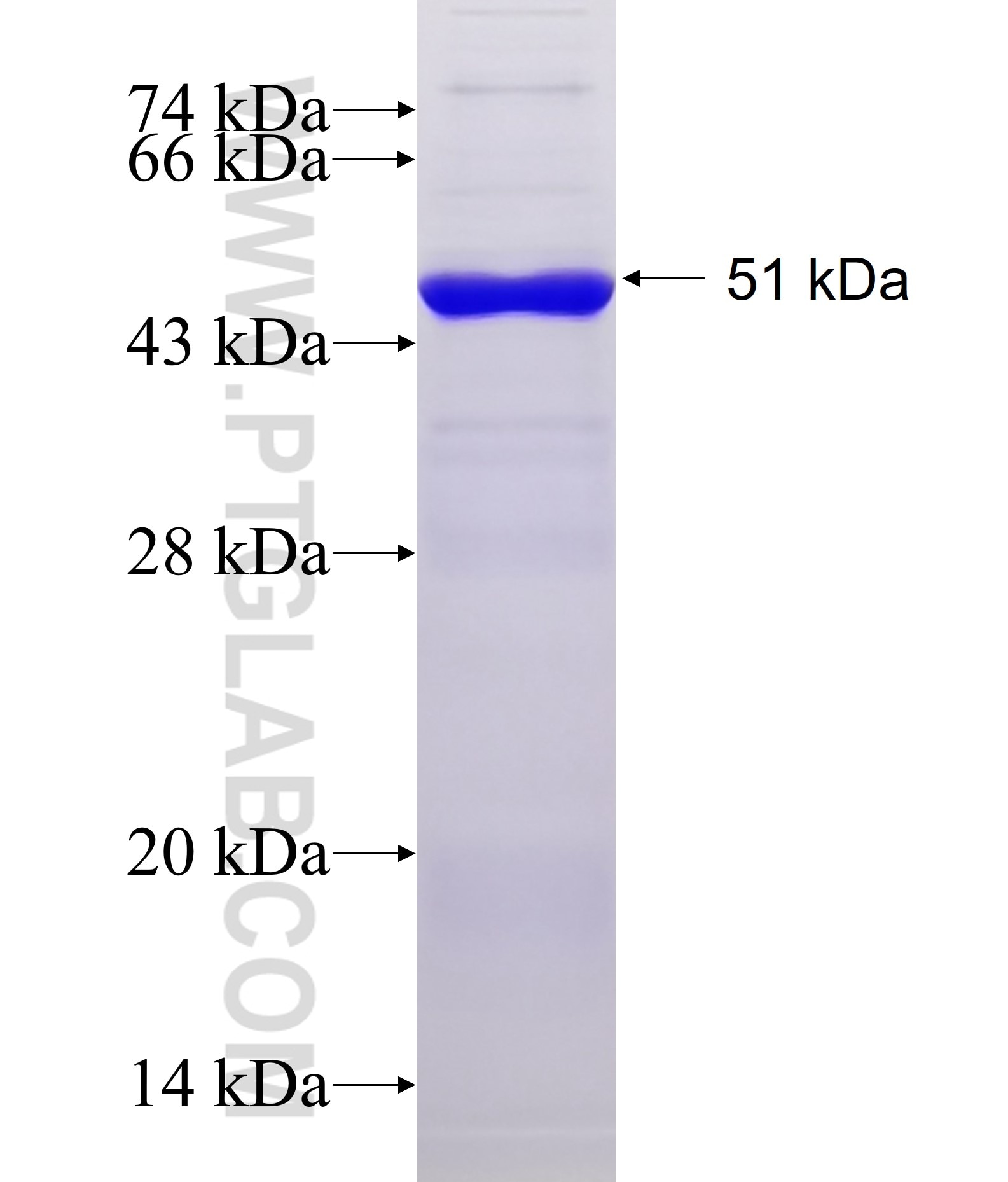 CABP7 fusion protein Ag11654 SDS-PAGE