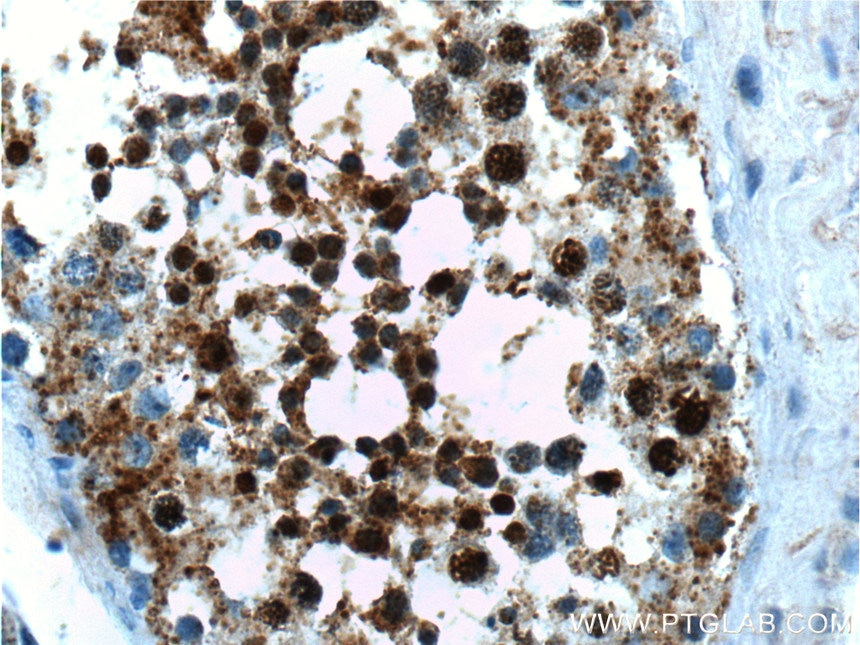 Immunohistochemistry (IHC) staining of human testis tissue using CABYR Polyclonal antibody (12351-1-AP)