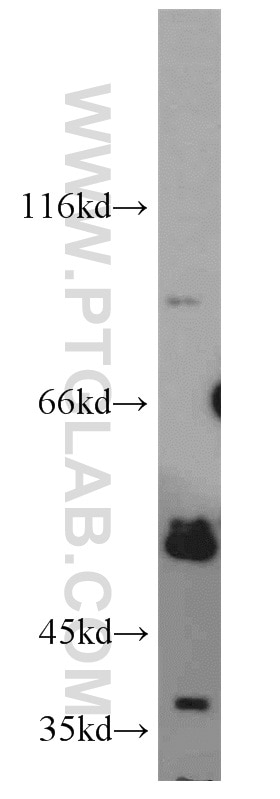 Western Blot (WB) analysis of mouse testis tissue using CABYR Polyclonal antibody (12351-1-AP)