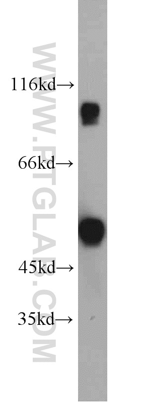 Western Blot (WB) analysis of human testis tissue using CABYR Polyclonal antibody (12351-1-AP)
