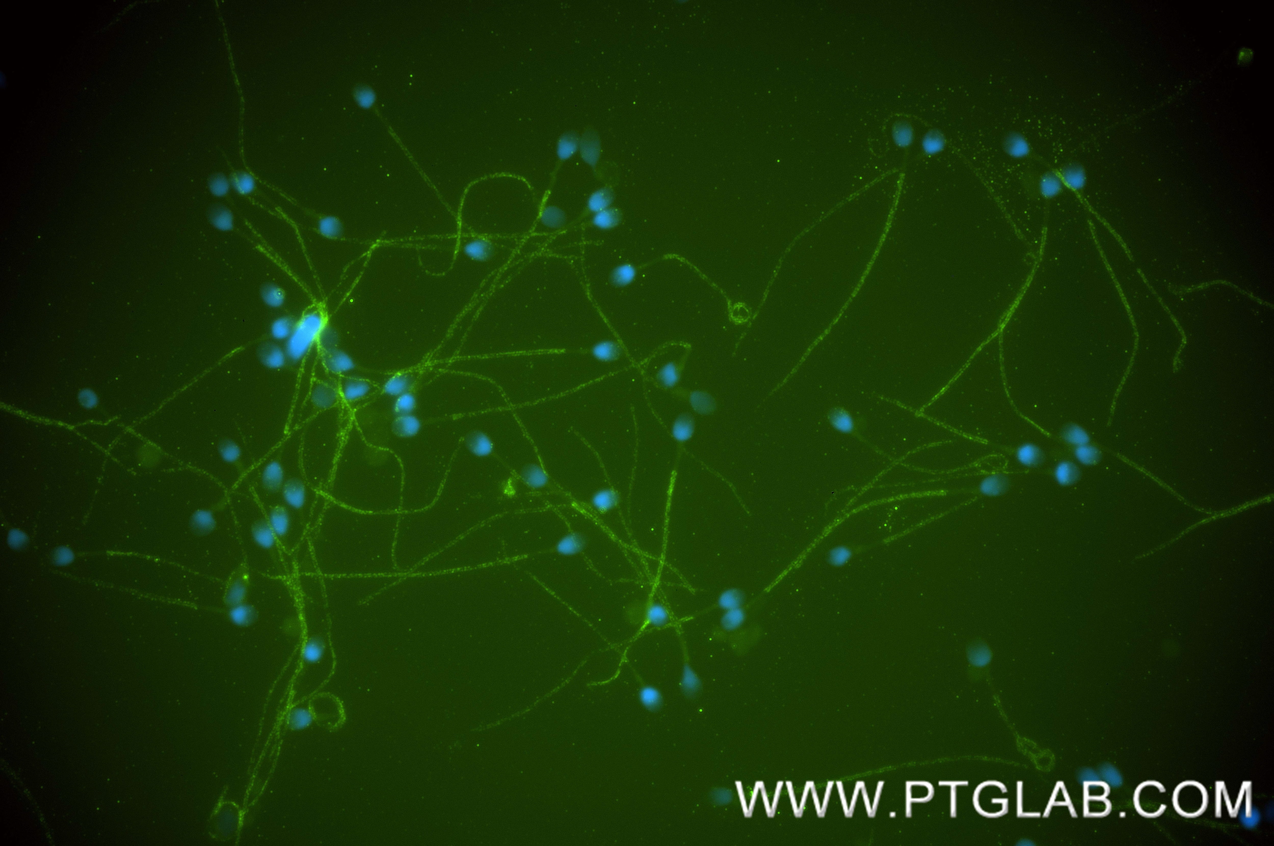 Immunofluorescence (IF) / fluorescent staining of human sperm cells using CABYR Recombinant monoclonal antibody (87074-1-RR)