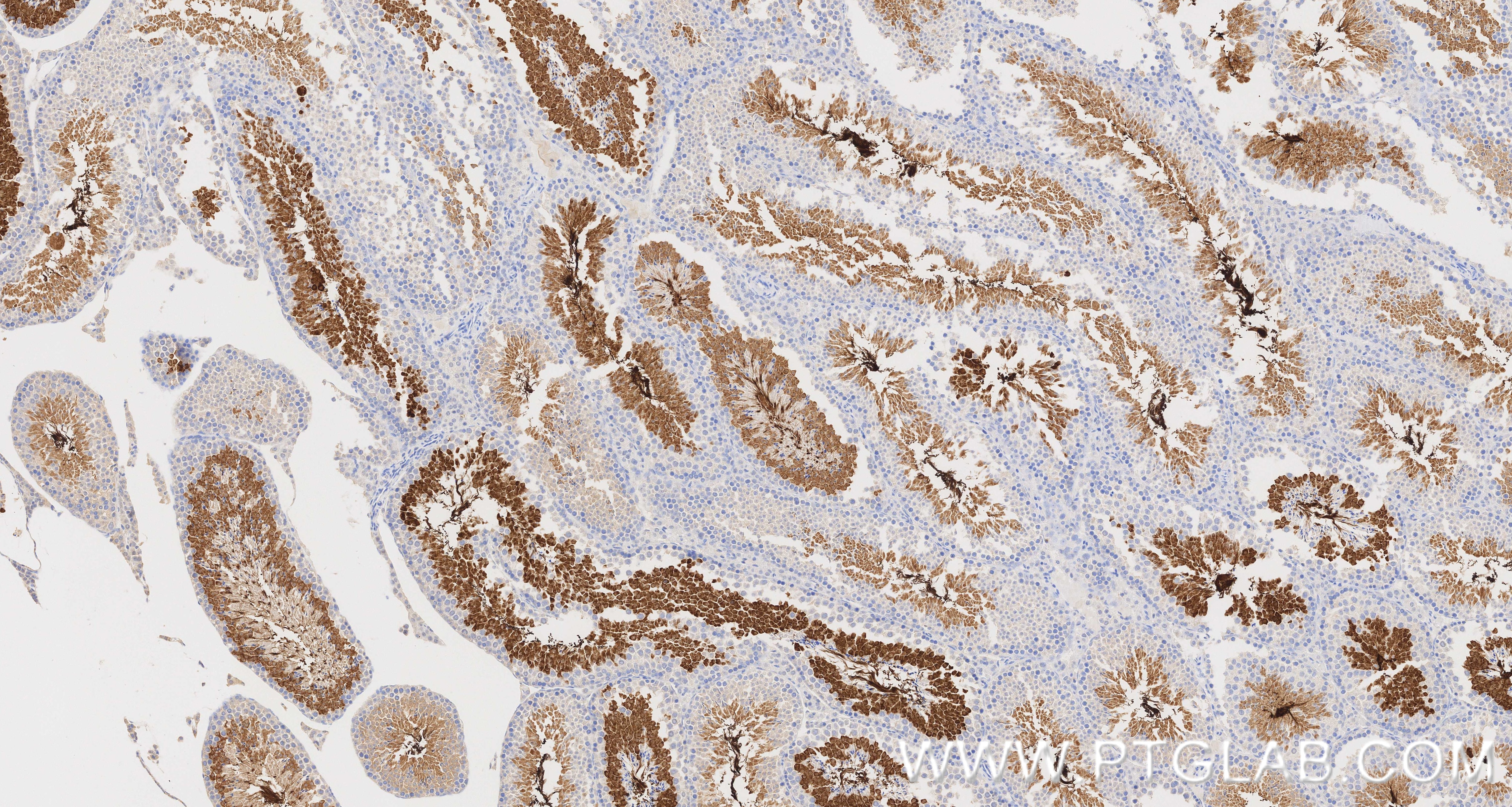 IHC staining of mouse testis using 87074-1-RR Immunohistochemistry (IHC) staining of mouse testis tissue using CABYR Recombinant monoclonal antibody (87074-1-RR)