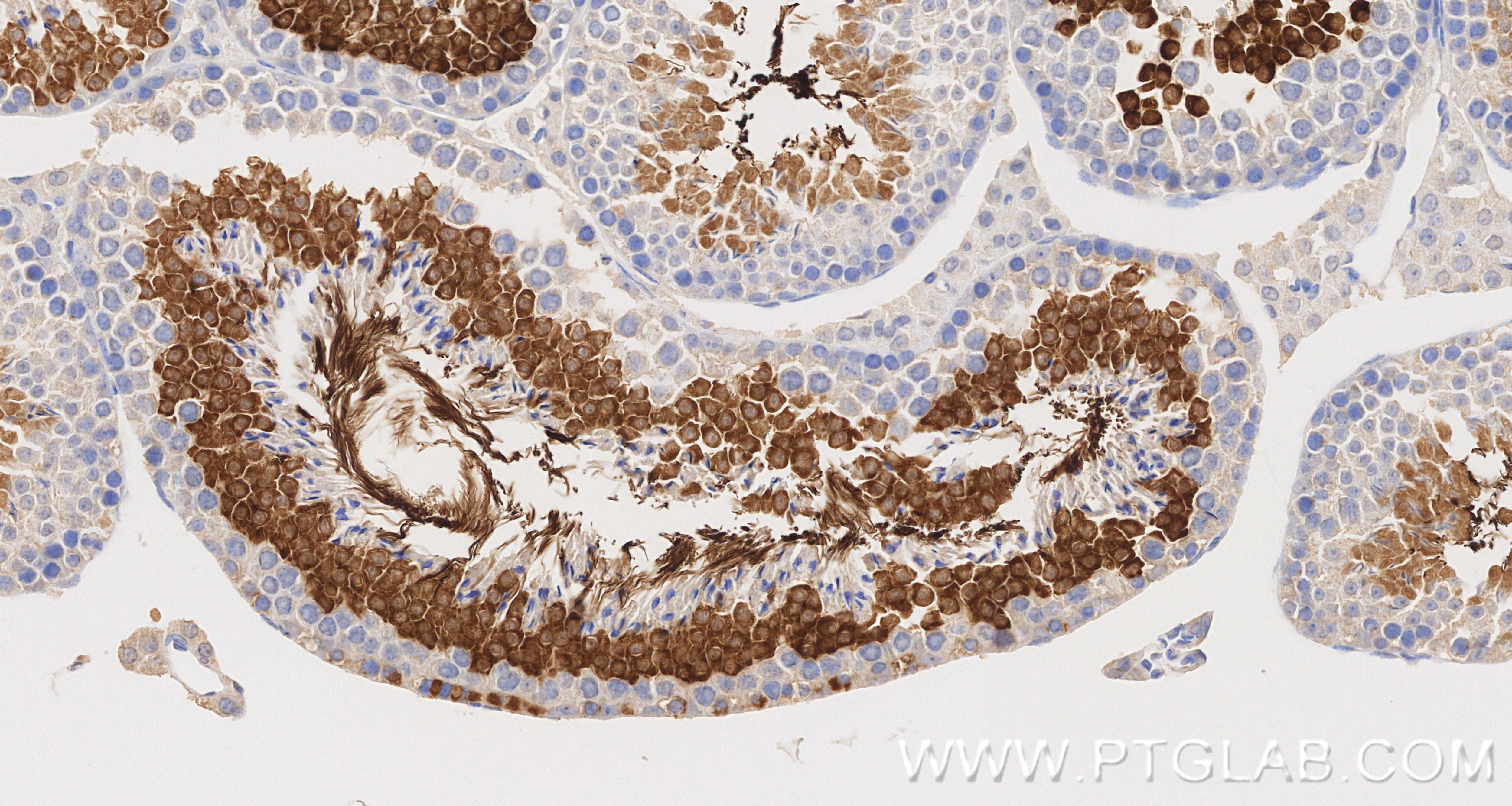 IHC staining of mouse testis using 87074-1-RR Immunohistochemistry (IHC) staining of mouse testis tissue using CABYR Recombinant monoclonal antibody (87074-1-RR)