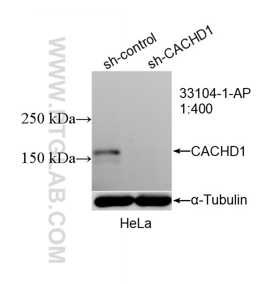 Western Blot (WB) analysis of HeLa cells using CACHD1 Polyclonal antibody (33104-1-AP)