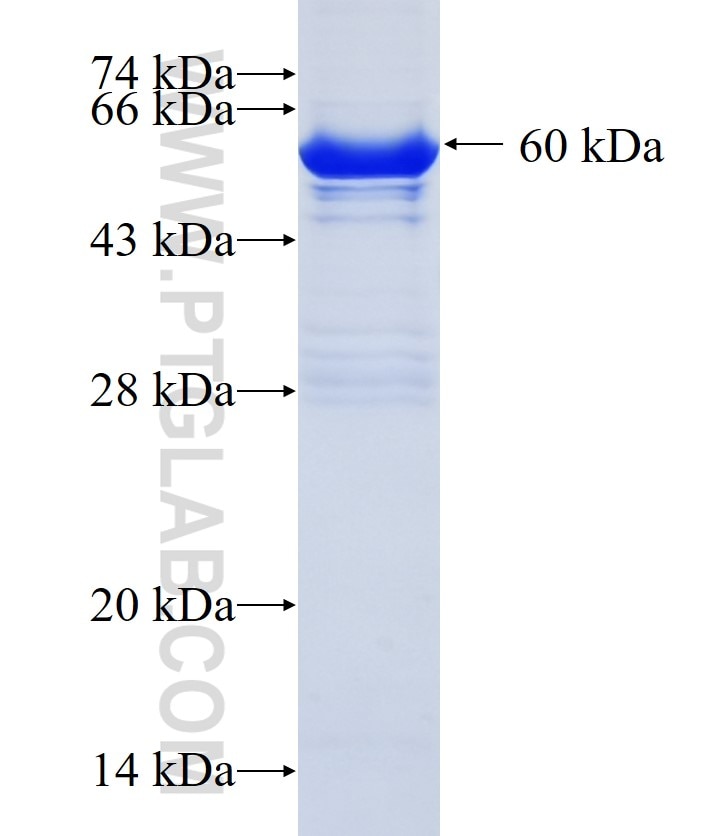 CACHD1 fusion protein Ag22138 SDS-PAGE