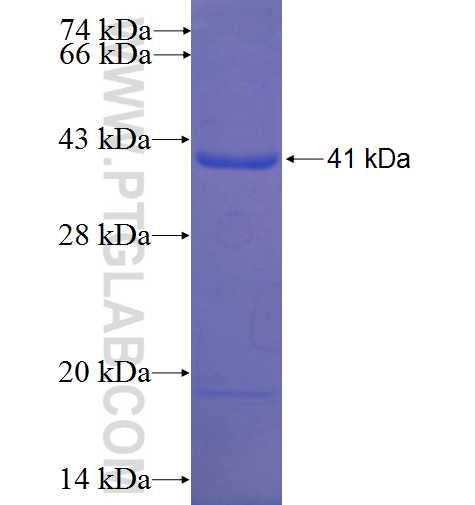 CACHD1 fusion protein Ag22575 SDS-PAGE