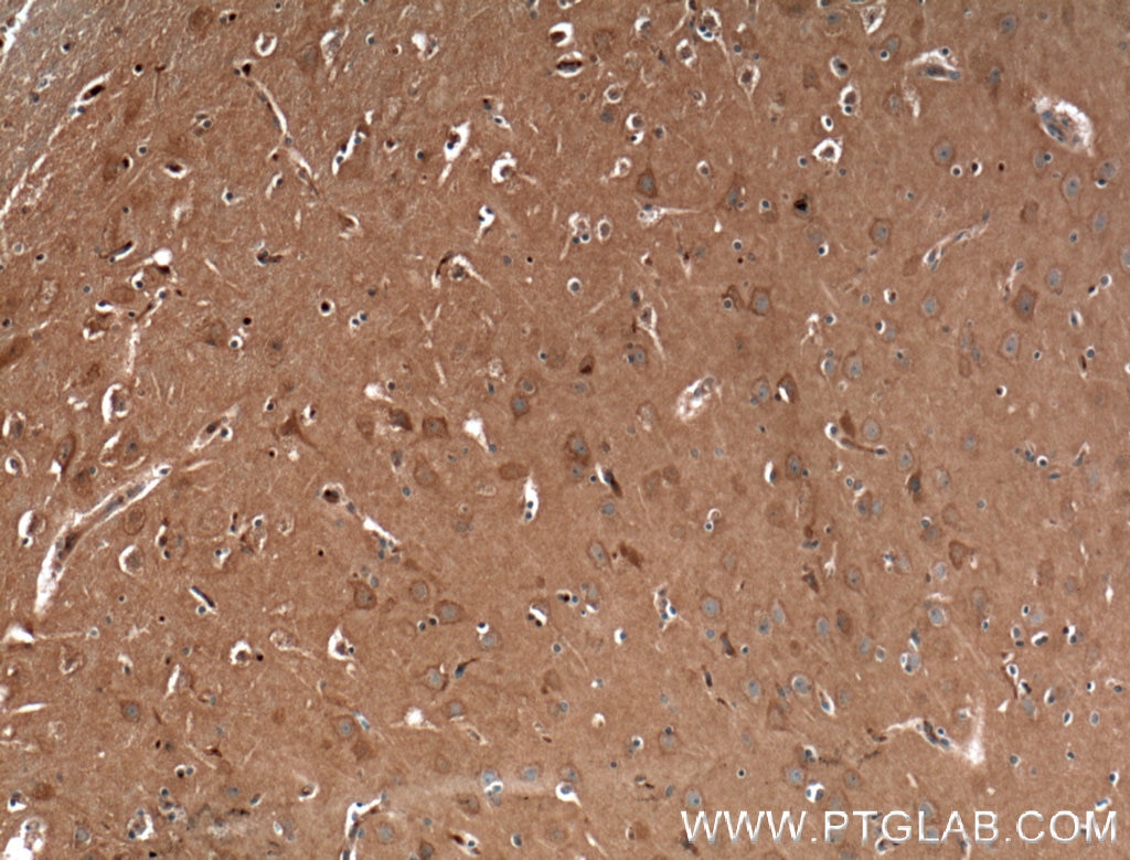 Immunohistochemistry (IHC) staining of human brain tissue using CACNA1A Polyclonal antibody (27227-1-AP)